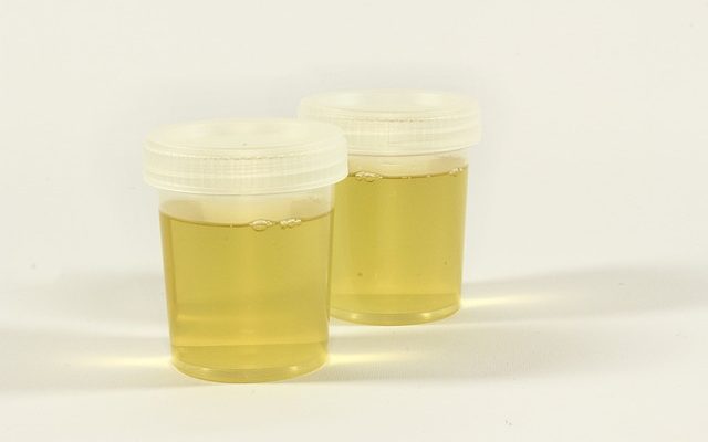 Produits pour neutraliser l'urine de chien sur l'herbe.